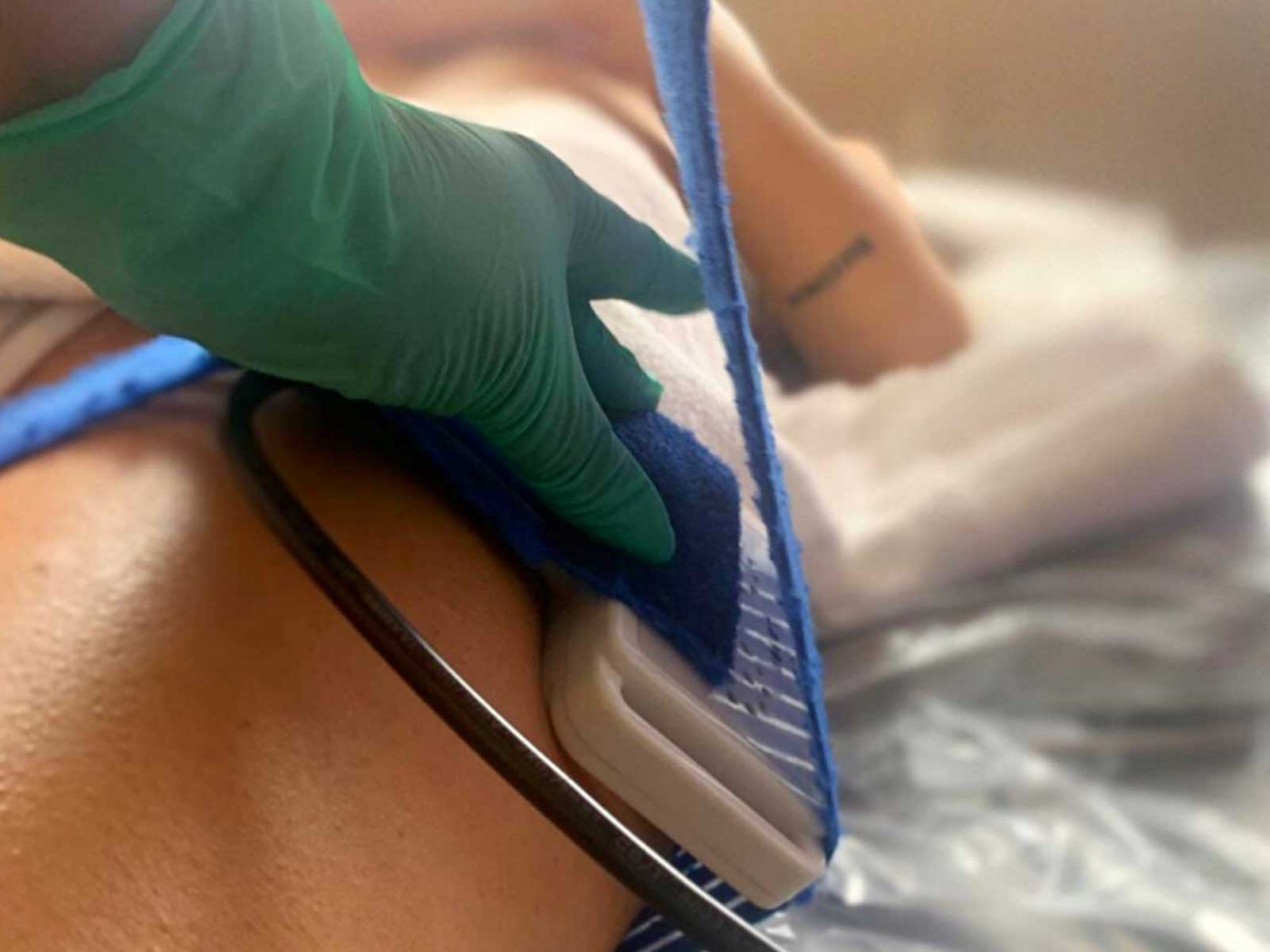 esthelab slim laser applicazione su gambe
