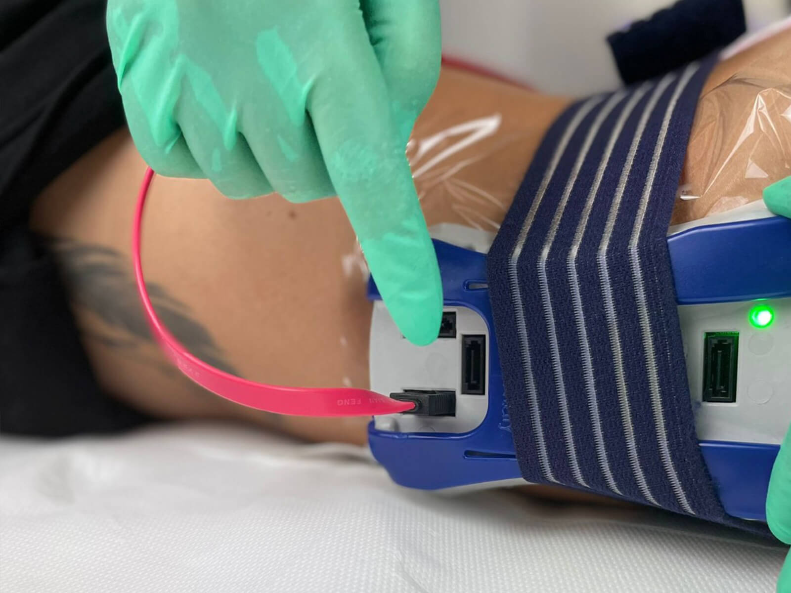 esthelab slim laser in uso